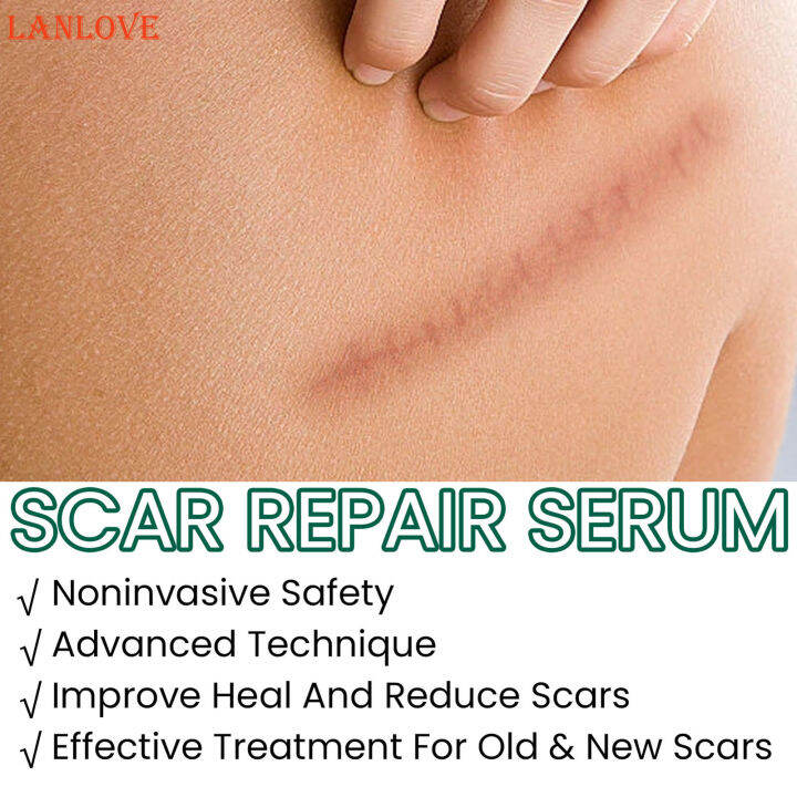 LANLOVE Scar Remove Medical Grade Scar Liquid Post Surgery Supplies