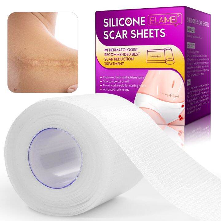 aliver-medical-silicone-gel-strips-patch-scar-away-tape-treatment-repair-skin-sheet-for-acne-trauma-burn-scar-skin-repair