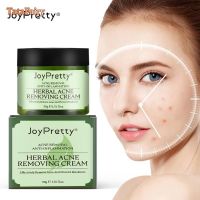 Tattie JoyPretty ครีมต่อต้านการสิวบนใบหน้าใหม่ระบบควบคุมน้ำมันที่กดสิวลดขนาดรูขุมขนสมูทครีม Aug