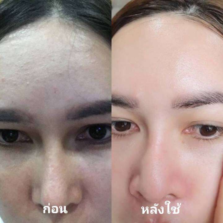 psc-สบู่หน้าเงา-aura-soap-1ก้อน-ขนาด-70g-princess-skin-care