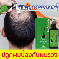 ?ปฏิเสธผมร่วง?Neo Hair Lotion นีโอแฮร์ ผลิตภัณฑ์สเปรย์ปลูกผมและบำรุงรากผม 120 ml.ปราศจากสารเคมี ฟื้นฟูรากผมด้วยสารสกัดธรรมชาติ เซรั่มปลูกผม น้ำยาปลูกผมดก น้ำยาเร่งผมยาว ยาปลูกผมของแท้ น้ำยาปลูกผมผู้ชาย ป้องกันผมร่วง ทำให้รากผมแข็งแรงมากขึ้น