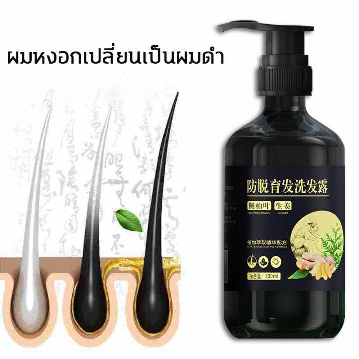 zhenxiu-แชมพูขิง-300ml-แชมพูแก้ผมร่วง-แชมพูขิงของแท้-แชมพูลดผมร่วง-แชมพูเร่งผมยาว-แชมพูปลูกผมดก-แชมพูขจัดรังแค-ยาสระผม-แชมพูสระผม-ยาสระผมแก้ร่วง-ยาสระผมเร่งยาว-แชมพูขิงเพียว-shampoo