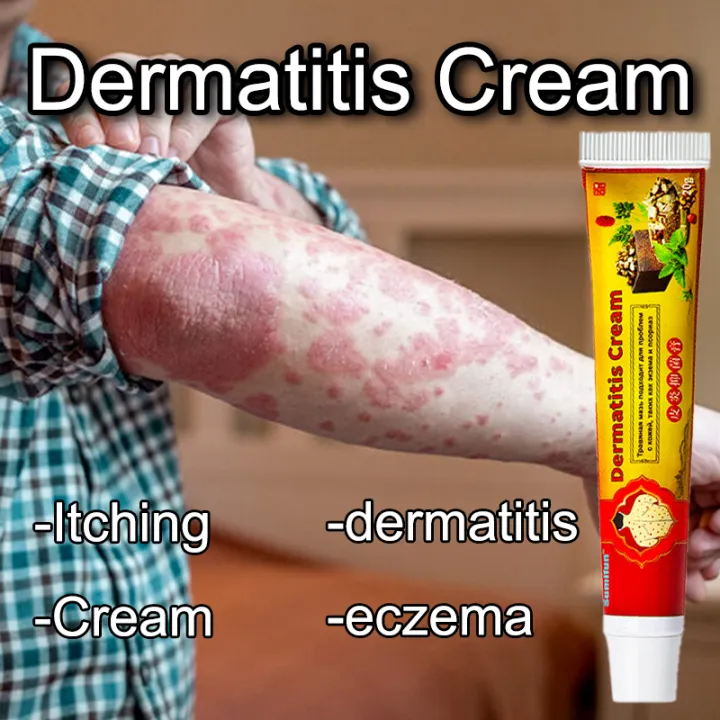 psoriasis ointment for skin disease Dermatitis eczema itching cream ...