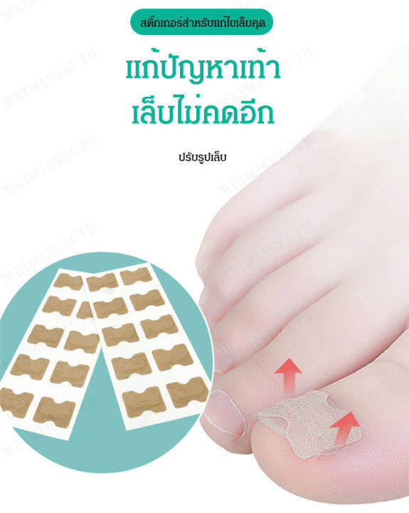 meimingzi-ชุดสติ๊กเกอร์สำหรับแก้ไขเล็บคุด