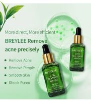 ( ของแท้ / พร้อมส่ง )**ขวดใหญ่สุด BREYLEE ACNE TREATMENT SERUM 40ML BREYLEE เซรั่มบำรุงผิว Acne Treatment Serum Facial Essence Anti Acne Scar Removal