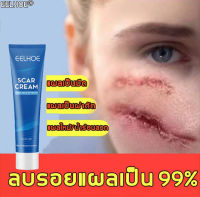 【สูตรใหม่】EELHOE ครีมลบแผลเป็น ซ่อมแซมแผลเป็น แผลเป็นผ่าตัด แผลไฟไหม้/น้ำร้อนลวก แผลเป็นนูนหนา แผลเป็นถลอก เร่งการซ่อมแซมให้ผิว（เจลลบรอยแผลเป็น ครีมรักษาแผลเป็น ครีมทาแผลเป็น ครีมลดรอยสิว ครีมลดแผลเป็น ครีมกำจัดรอยแผลเป็น Repair Scar Cream）