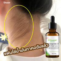 Disaar เซรั่มปลูกผม น้ำยาปลูกผม30ml ช่วยปรับปรุงผมร่วง เร่งการเจริญเติบโตของเส้นผม ยาปลูกผมของแท้ เซรั่มบำรุงผม ปลูกผม สำหรับผมบาง นีโอแฮร์ของแท้ สเปรย์ปลูกผม น้ำยาปลูกผมชาย ปลูกผมเร่งด่วน น้ำยาใส่ผม น้ำยาเร่งผมยาว