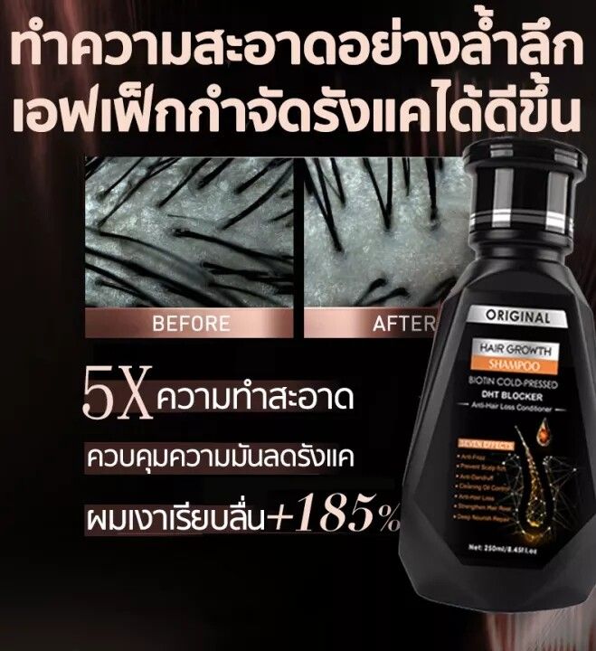 ลดกระหน่ำ-peimei-แชมพูแก้ผมร่วง-ยาสระผมเร่งยาว-ยาสระผมแก้ร่วง-250ml-สูตรน้ำขิง-ปลูกผมอย่างอ่อนโยน-บำรุงรากผม-แชมพูปลูกผมดก-แชมพูสระผม-แชมพูเร่งผมยาว-แชมพูลดผมดก-แชมพูขิง-แชมพูสมุนไพร-แชมพูป้องกัน-ร่วง