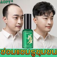 [ เค้าเตอร์แบรนด์แท้ 100% ส่งสินค้าจากกทม]AOPY เซรั่มปลูกผม ปลูกผมของแท้ ปลูกผมหนา ช่วยลดผมร่วง ป้องกันผมร่วง ปลูกหนวด เร่งผมยาว น้ำปลูกผม