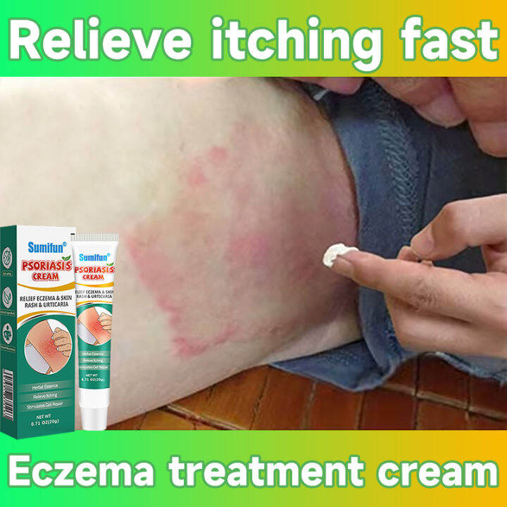【Sumifun】Eczema Treatment Cream gamot sa kati kati sa balat buni ...
