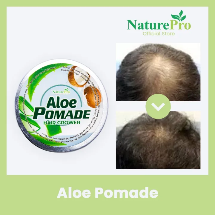 Nature Pro Aloe Pomade Hair Grower Anti Hair Loss Treatment Prevent