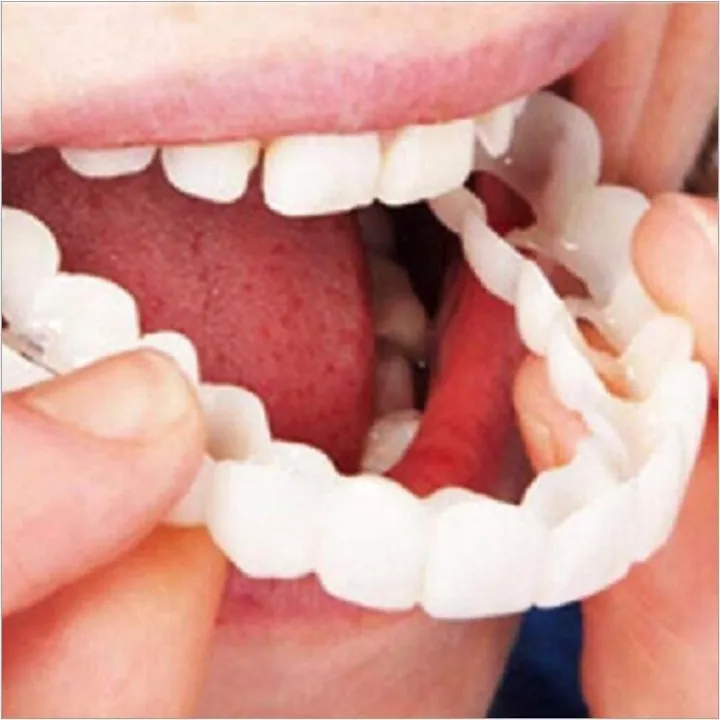 HBESTY [[TIKTOK HOT]*]Soft silicone dentures occlusal veneers face