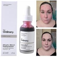 the ordinary มาร์คแดง มาร์คแวมไพร์ AHA30% + BHA2%