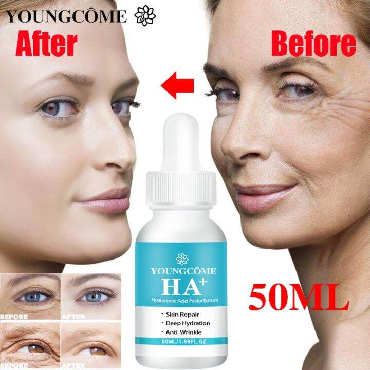 Natural Retinol Anti Aging Whitening Face Cream Hyaluronic
