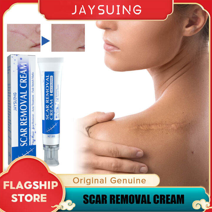 Jaysuing Scar Removal Cream Gel Remove Acne Spots Treatment Stretch Marks Burn Surgical Scar 6176