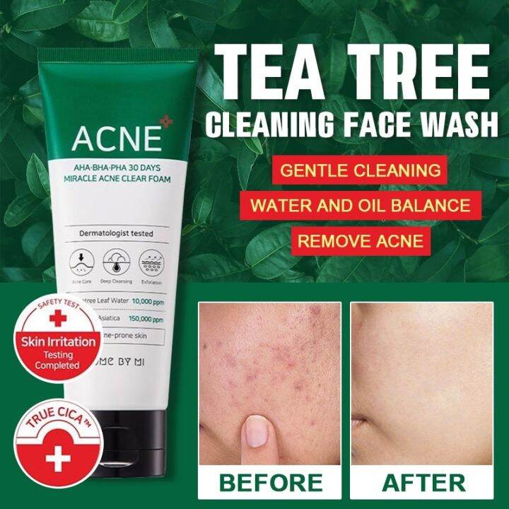 [SOME BY MI] AHA BHA PHA 30 Days Miracle Acne Clear Foam Authentic