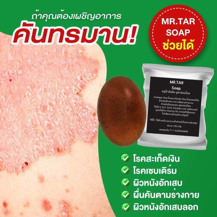 mr-tar-soap-สบู่น้ำมันดิน100กรัมแท้-สูตรอ่อนโยน-สบู่ผิวหนังอักเสบทุกประเภท-สะเก็ดเงิน-ชุดสุดคุ้ม-1-แถม-1-ส่งไว