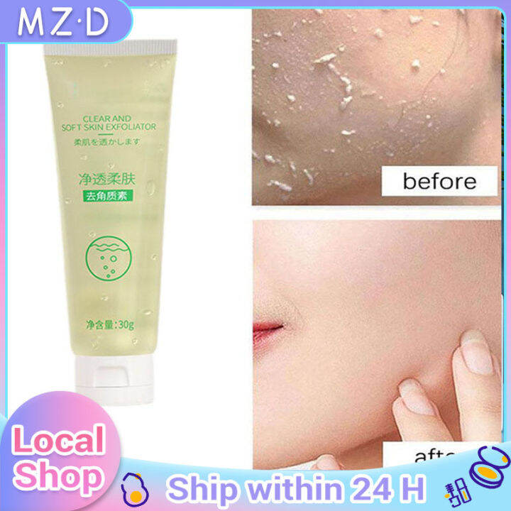 Exfoliating Whitening Gel Body Scrub Facial Exfoliating Gel Peeling Gel
