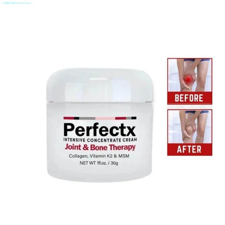 PERFECTX Joint Bone Therapy Cream 30G Joint Knee Pain Toe Bone Pain ...