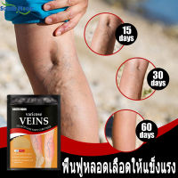 แผ่นแปะเส้นเลือดขอด varicose veins เส้นเลือดขอด ส่งเสริมการไหลเวียนโลหิต ฟื้นฟูหลอดเลือดให้ บอกลาเส้นเลือดขอดเส้นเลือดดำอุดตันและอาการปวด แผ่นครีมเส้นเลือดขอด แผ่นแปะเส้นเลือดขอด แผ่นแปะแก้เส้นเลือดขอด