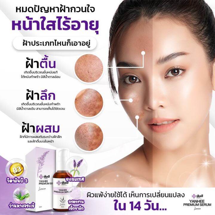 ส่งฟรีส่งด่วนใน1วัน-เซ็ตคู่2ชิ้น-ยันฮีพรีเมี่ยมเซรั่ม-ยันฮีพรีเมี่ยมเมล่าครีม-ฝ้าหาย-ฝ้าเรื้อรัง-ฝ้าเป็นมานาน-สิว-ฝ้า-กระ-ริ้วรอย