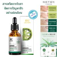 สินค้าแนะนำ พร้อมส่ง ANTI-ACNE REPAIR LIQUID GommW6 สารสกัดจาก ใบชา