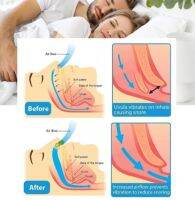 Anti-Snoring Corrector Snore Prevention Gadget Womens Anti-Snore Device Snore Elimination Nose Clip Mens Sleep Night