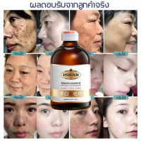 พร้อมส่ง ครีมทาฝ้ากระ เซรั่มกำจัดฝ้า Whitening serum เซรั่มไวเทนนิ่ง DSIUAN เซรั่มบำรุงผิวหน้า บำรุงผิวหน้า เซรั่มกระไวท์เทนนิ่ง เซรั่มทาหน้าทำให้ฝ้าจางลง เซรั่มทาหน้าขาว100ml ครีมแก้ฝ้ากระ