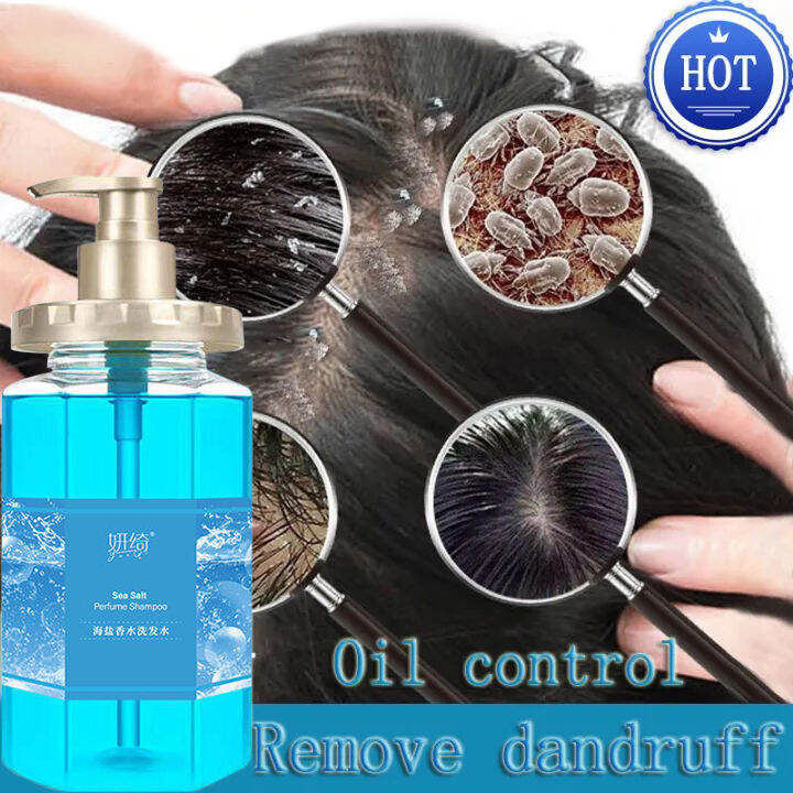 Sea Salt Anti Dandruff Shampoo for Scalp Itching and Dandruff anti Hair ...