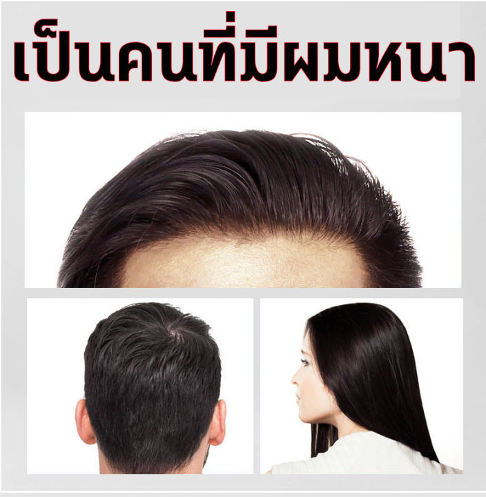 ซื้อ-1-แถม-1-แชมพูเร่งผมยาว-แชมพู-แชมพูขิง-แชมพูสระผม-ป้องกันผมร่วง-แชมพูกรดอ่อน-ขิงช่วยป้องกันผมร่วง-ยาสระผมแก้ร่วง-ผู้หญิงผมร่วง-ผู้ชายผมร่วง-บำรุงเส้นผมและรากผม-ผมบาง-หัวล้าน-แชมพูขิงเพียว-แชมพู-บำ