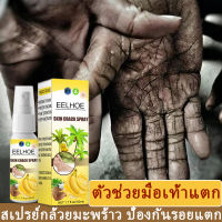 EELHOE สเปรย์ฉีดเท้า 50ml ครีมทาส้นเท้า ครีมดูแลเท้า ครีมบำรุงเท้า ครีมทาเท้าขาว ทาเท้าคัน ครีมทามือ ครีมนวดเท้า บรรเทาอาการคัน ดูแลมือ โลชั่นทาเท้า ครีมส้นเท้าแตก ผิวเท้านุ่มเนียน ครีมทาเท้าแตก ครีมทาส้นแตก ครีมส้นเท้า สเปรย์ฉีดดูแลเท้า สเปรย์บำรุงเท้า