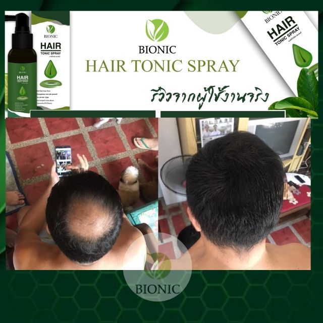 bionic-hair-tonic-spray-100ml-ผลิตภัณฑ์-ไบโอนิค-แฮร์โทนิค-สูตรเข้มข้น-บำรุง-เส้นผมและหนังศีรษะ-1ชิ้น