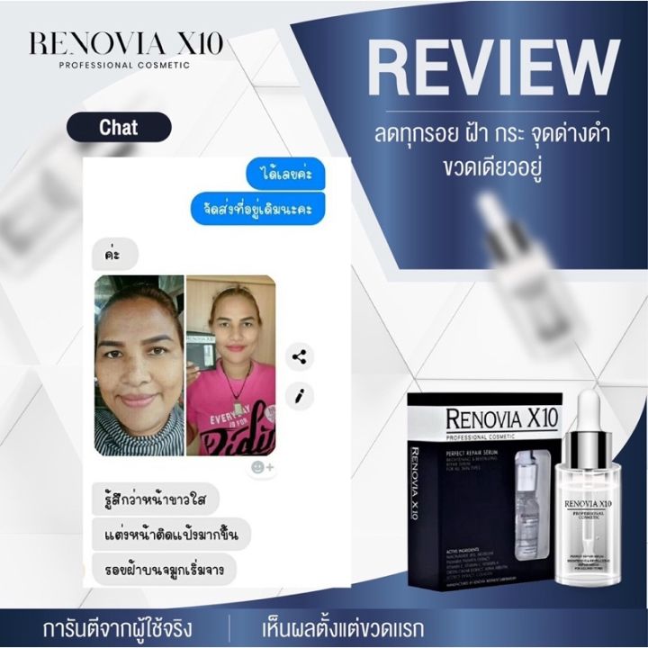 ตรงปก-จบปัญหาผิวหน้า-ของแท้-renovia-x10เซรั่มหน้าใส-ลดฝ้ากระจุดด่างดำ-ฺั-by-18-อีกครั้ง