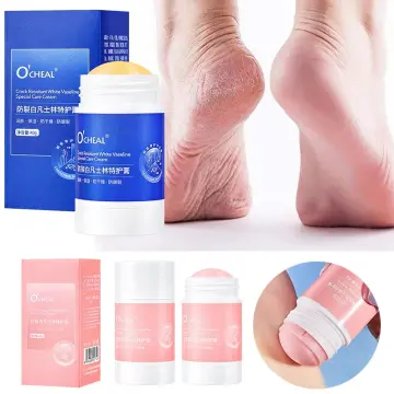 Healing Dry Feet And Cracked Heels - Easy Treatment That Works Fast