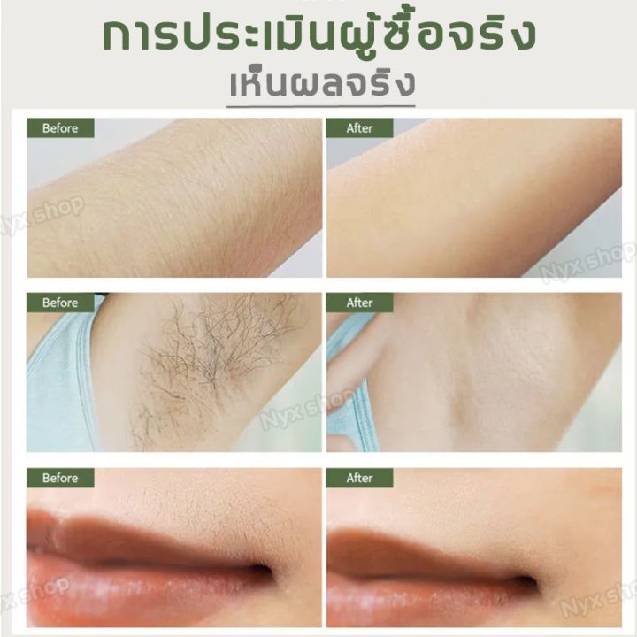 กำจัดขนถาวร-เครื่องกำจัดขน-เหมาะสำหรับทั้งร่างกาย-ชาร์จได้ล้างได้-ออกแบบมาสำหรับผู้หญิงโดยเฉพาะ-เครื่องถอนขนไฟฟ้า-ที่ถอนขนรักแร้-เครื่องกำจัดขนรักแร้-เครื่องกำจัดขนไฟฟ้า-เครื่องโกนขนไฟฟ้า-ที่โกนขนไฟฟ้