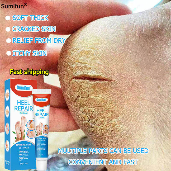 Hands and foot essentials! Sumifun Foot Cream for Dry and Rough Heels