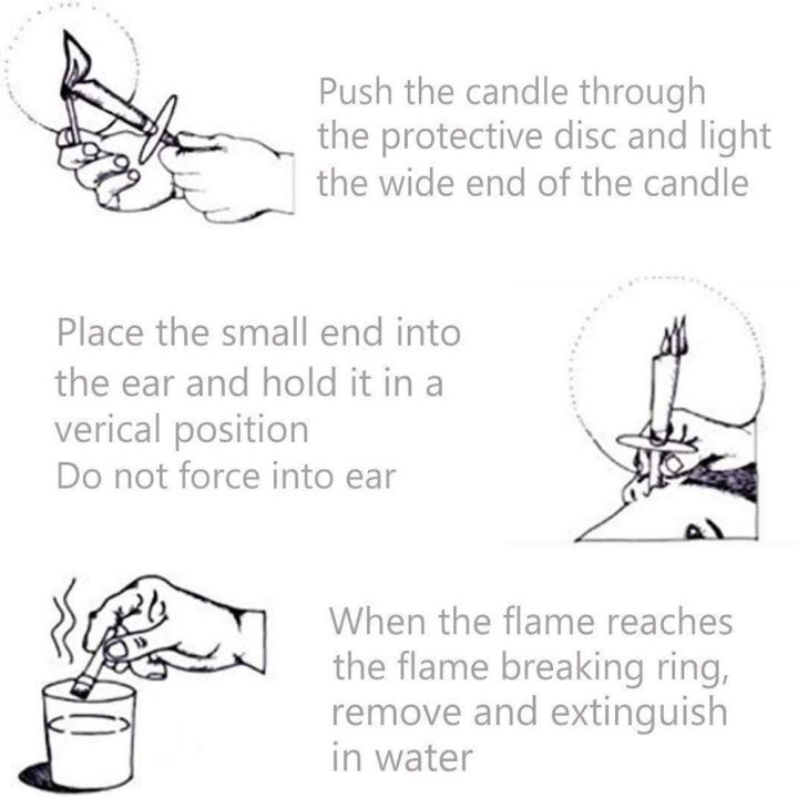 crystal-rabbit-10-ชิ้น-เทียนหู-สไตล์ทรัมเป็ต-น้ำยาล้างขี้หู-กำจัดขี้ผึ้งฮอร์นปลั๊กอุดหู-เทียนขี้หู-พร้อมสำลีก้าน-earwax-remover-candle-set