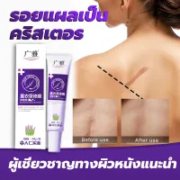 เหมาะสำหรับรอยแผลเป็นทุกชนิด‍⚕️Scar cream ครีมลดรอยแผลเป็น แผลน้ำร้อนลวก ครีมลบรอยแผลเป็น ครีมลบแผลเป็น ครีมลบแผลเป็น ยาทาแผลเป็นนูนเจล ลบรอยแผลเป็น แก้ปัญหารอยแผลต่างๆ ครีมลดรอยสิว แผลผ่าตัด ครีมลดแผลเป็น แผลเป็น ลบรอยแผลเปน  สูตรพฤกษศาสตร์