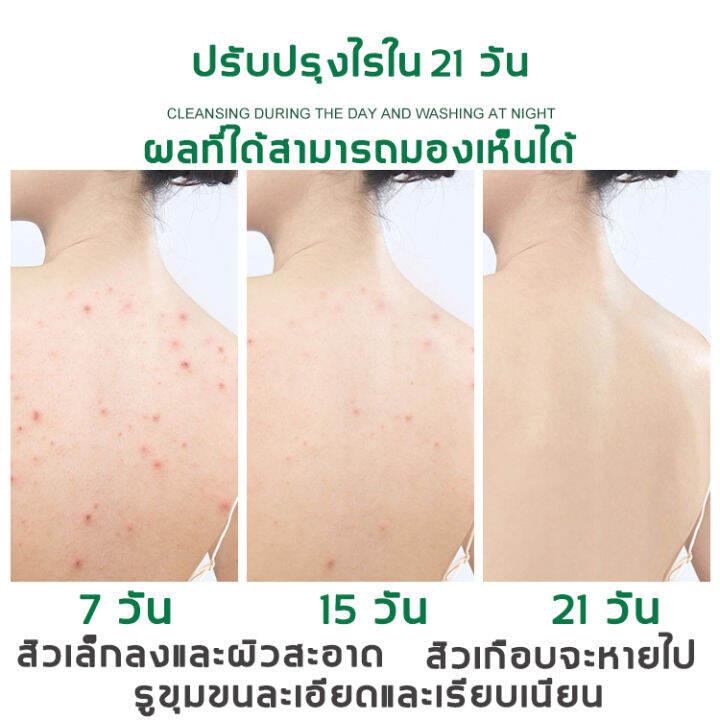 zilin-สบู่สูตรลับโสม-100g-สบู่กำจัดไร-มีเนื้อสัมผัสอ่อนโยนใช้ได้ทั้งตัว-ป้องกันผิวมัน-เหมาะสำหรับผิวที่มีปัญหาสิว-สบู่อาบน้ำ-สบู่ล้างเครื่องสำอางค์-สบู่หน้าเงา-สบู่ลดสิวหน้า-สบู่ก้อน-สบู่ป้องกันแบคทีเ