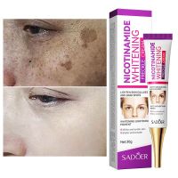 Nicotinamide Dark Spots Whitening Cream Brightening Melanin Melasma Blemishes Pigmentation Acne Marks Face Whitening Cream Women