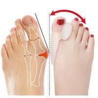 ▩☽❦ 1pair Hallux Valgus Broadhurst Pad Remedical Bone Thumb Silica Gel Daily Use Silicone Foot Care Sets Toe Bunion Protector