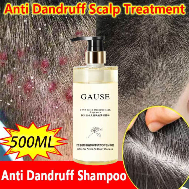 anti dandruff shampoo 500MLFast Effective Anti Dandruff and Scalp ...