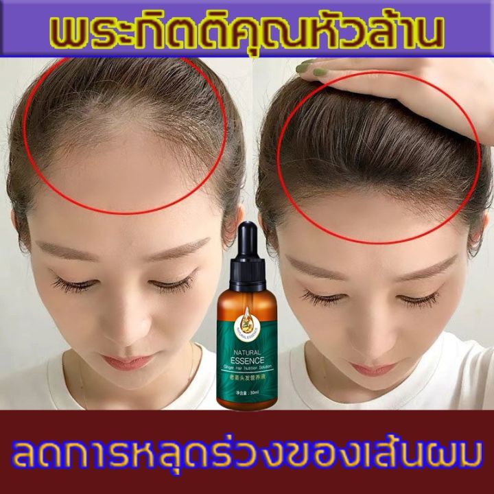 7days-เซรั่มบำรุงผม-ยาปลูกผมของแท้-เร่งผมขึ้นใหม่-40ml-เร่งผมยาวไว-ป้องกันผมร่วง-บอกลาหัวล้าน-แบรนด์เก่า-ผู้ช่วยสำหรับการปลูกผม-บำรุงผม-ยาปลูกผม-น้ำยาปลูกผม-น้ำยาเร่งผมยาว-เซรั่มปลูกผม-ปลูกผมเร่งด่วน-