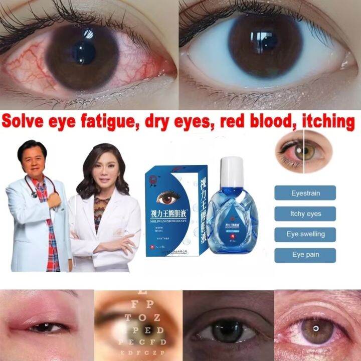 YANHE original eye drops, eye fatigue, water, cataract, dry and painful ...