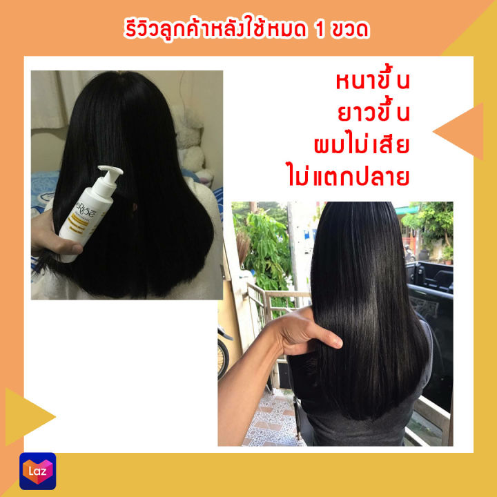 ใช้แล้วไม่เห็นผลยินดีคืน-2เท่า-serise-hair-serum-เซริเซ่-เซรั่มอาหารผม-เร่งผมยาว-พร้อมบำรุงผมเสีย-อาหารผม-120-ml