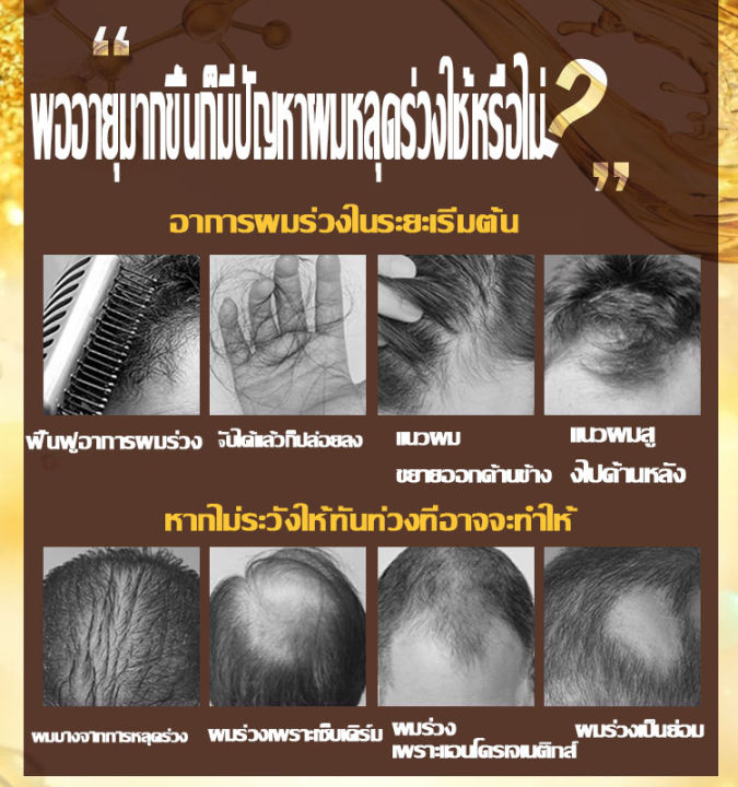 hemeiel-น้ำยาปลูกผม-ที่เร่งผมยาว-บำรุงผมยาวเร็ว-ไม่ต้องกังวลกับปัญหาผม-hair-serum