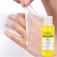 【CW】 Yellow Peeling Oil Strong Yellow Peeling Oil Lighten Elbows Knees Hands Melanin Even Skin Tone And Whiten Skin 30ml / 50ml