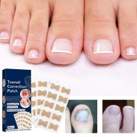 【CW】►  50pcs Correction Stickers Ingrown Toenail Corrector Painless Pedicure Paronychia Treatment Tools