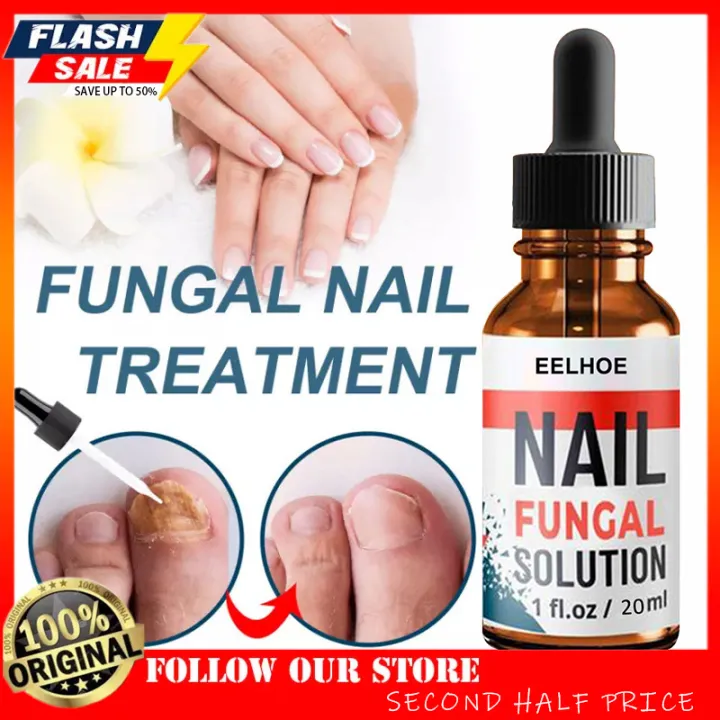 SECOND HALF PRICE 🔥【COD】 Antibacterial Nail Treatments Nail Repair