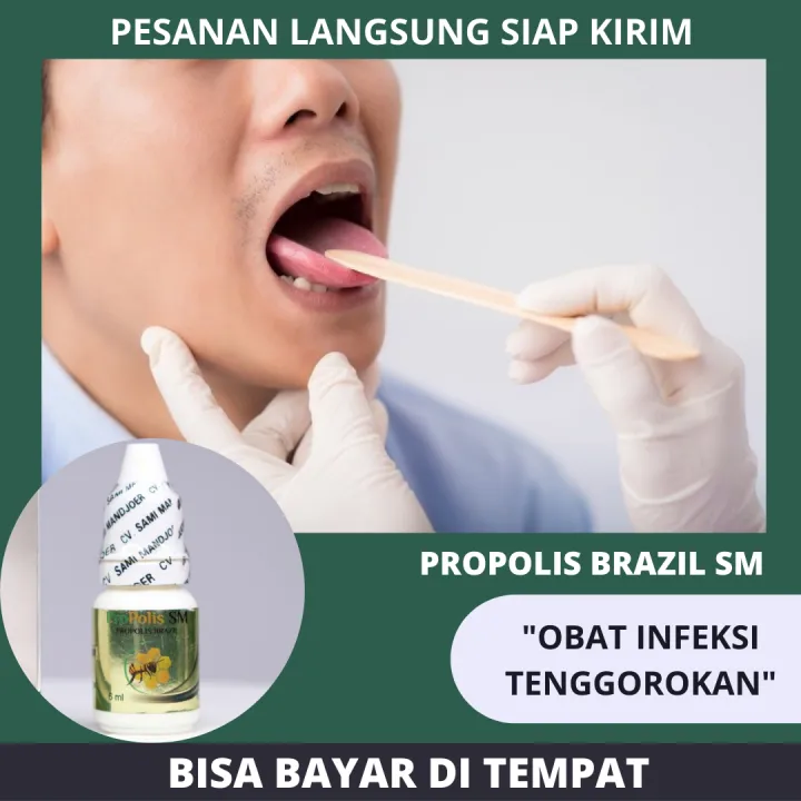 Obat Radang Tenggorokan Herbal Nyeri Menelan Kerongkongan Kering Perih ...